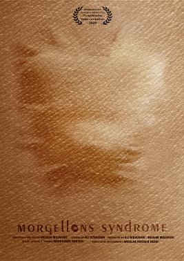 Morgellons Syndrome